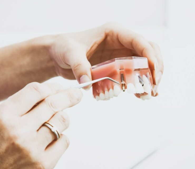 Attracting and Retaining the Best Dental Professionals: Tips and Tricks